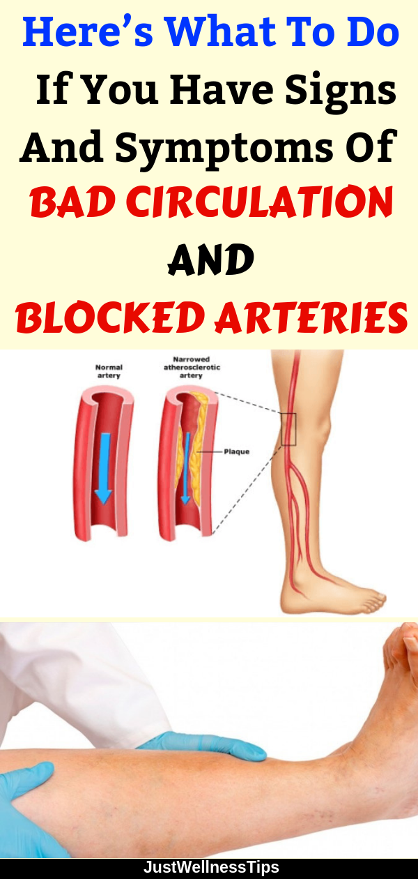 Here’s What To Do If You Have Signs And Symptoms Of Bad Circulation And