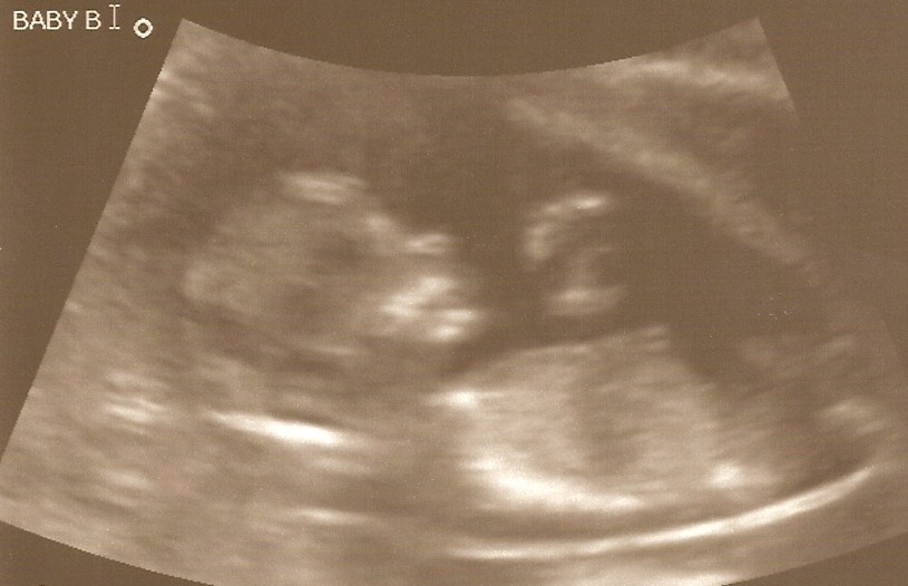 The last time people were excited to see me. - 9GAG