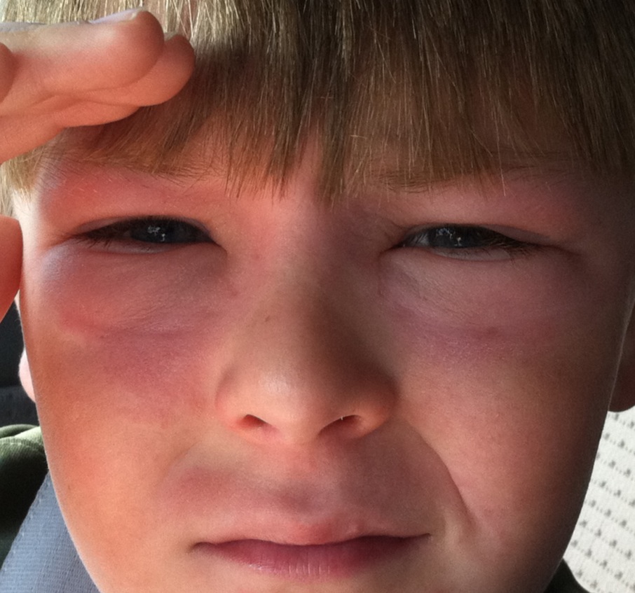 6 TN Hills Poison Ivy (again)