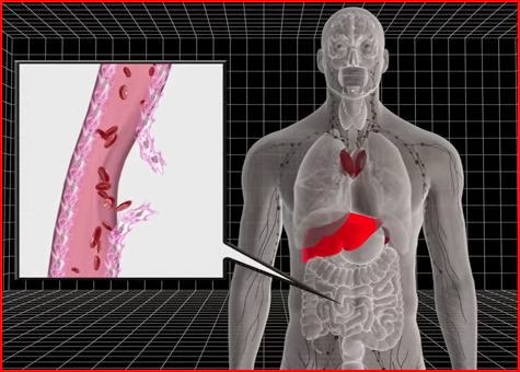Ebola Virus animatedfilmreviews.filminspector.com