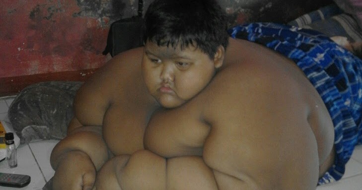 Gara-Gara Kegemukan, Bocah Ini Tidak Kuat Lagi Untuk Sekolah Arya