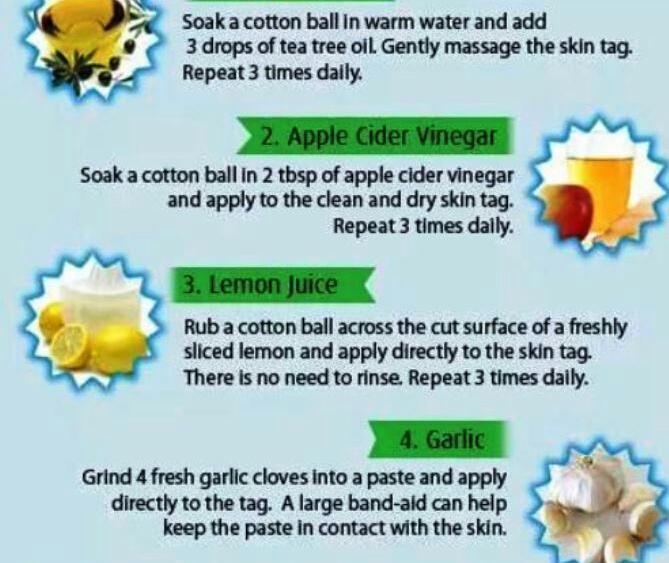 How to Remove  skin tag at home