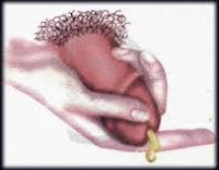 Obat Sembuhkan Penis Keluar Cairan Putih Pada Celana Dalam Obat Sembuhkan Penis Keluar Cairan Putih Pada Celana Dalam