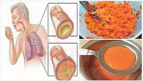 همسه وصفة سحرية للتخلص من السعال وتنظيف الرئه تماما من البلغم