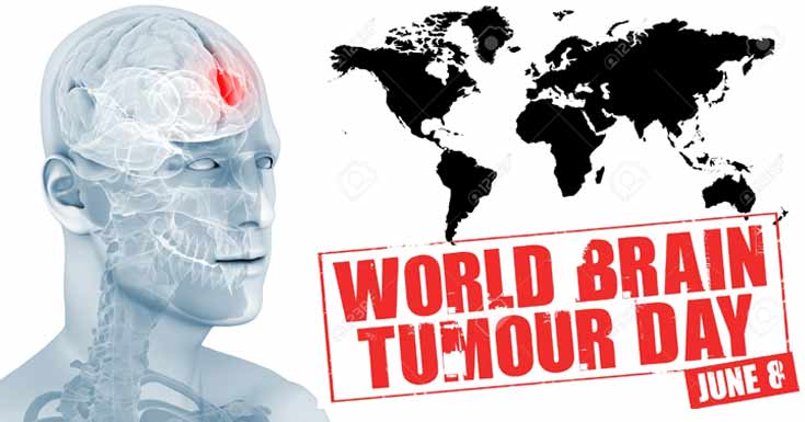 World brain. World Brain Day. World Brain tumor Day. Всемирный день мозга (World Brain Day).