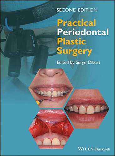 Periodontics Free We Book Download Periodontics Free We Book Download