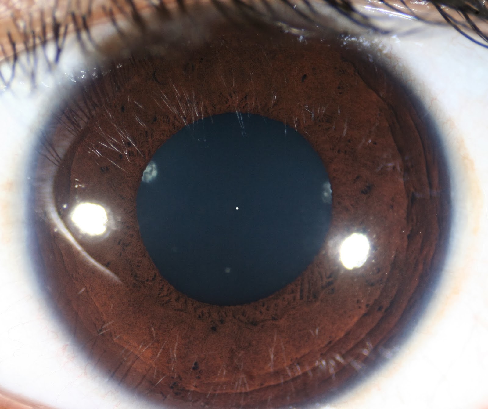 modern-multidimensional-iridology-crypt-collarette-structure-rx