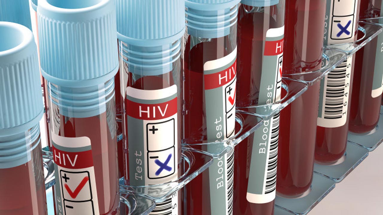 Lagos records over 24,000 HIV positive cases in two years KokoLevel Blog