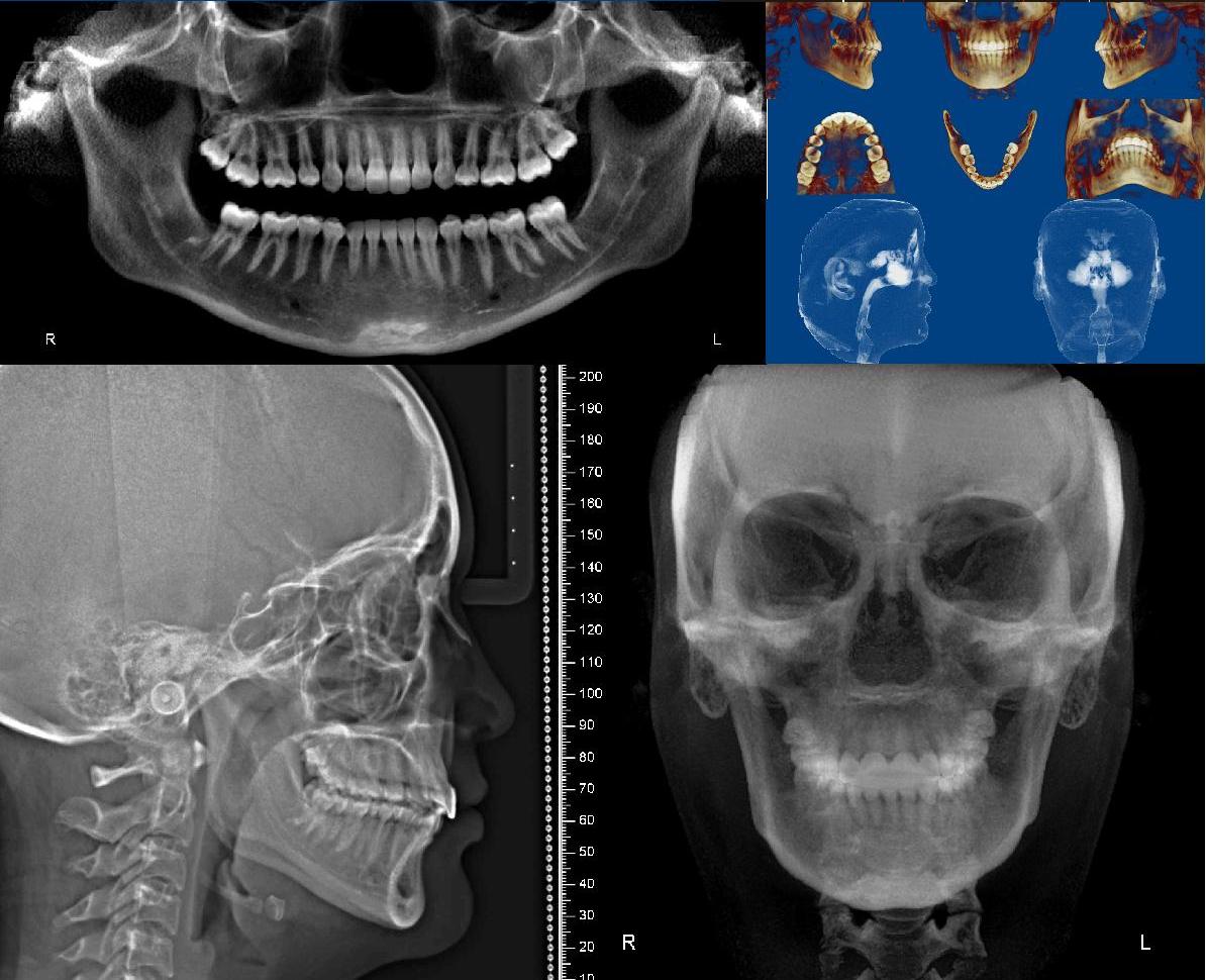 Dento Metric Radiología Oral Y Maxilofacial