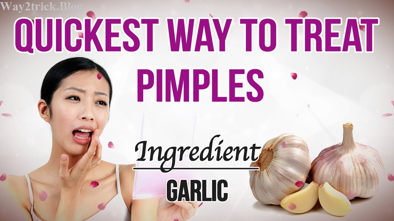How to Get Rid of Pimples Fast Way2Trick
