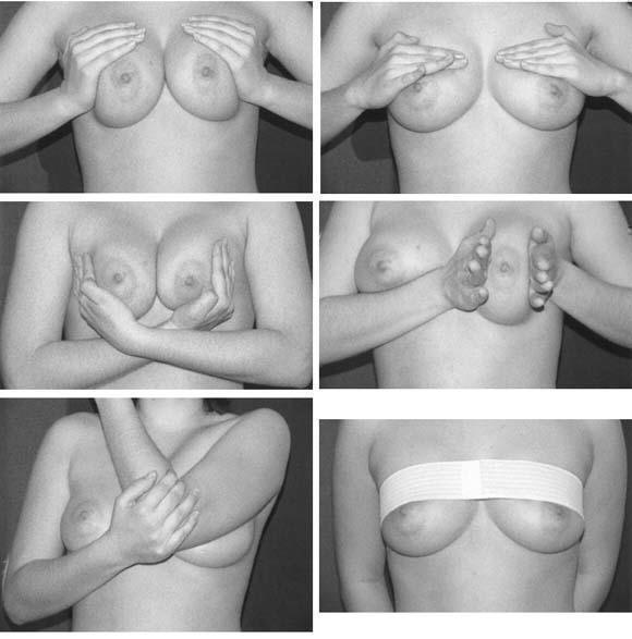 Diagrams Self Breast Massage Implants 77