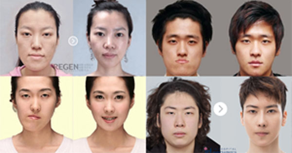 21 Plastic Surgeries In Korea That Will Surely Make You Believe In Magic! 21 Plastic Surgeries In Korea That Will Surely Make You Believe In Magic!