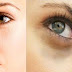 علاج الهالات الغامقة حول العين