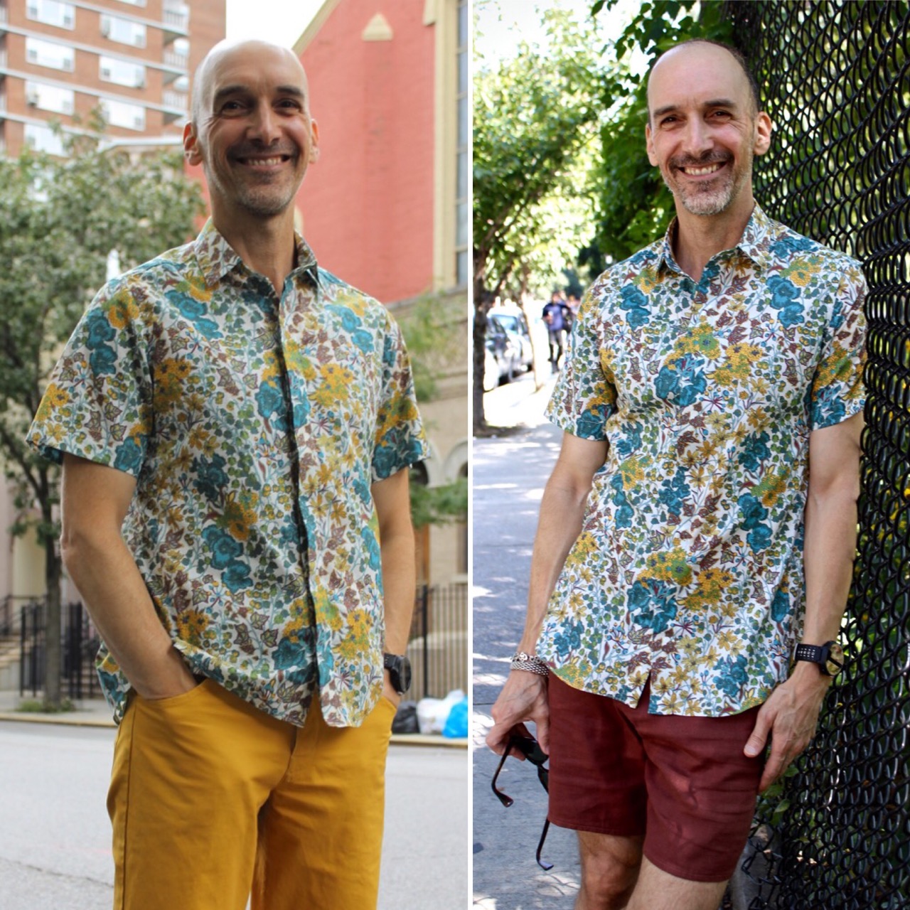 male-pattern-boldness