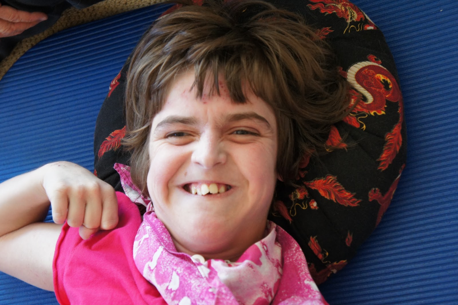 Умственная отсталость дебил. Умственно отсталые дети. Как выглядят умственно отсталые. Умственно отсталые подростки. Легкая форма олигофрении.