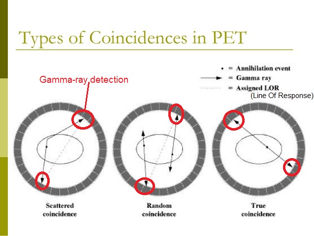 PET/CT Combined Scanners - a 2018 Breakthrough of the Year... and a ...