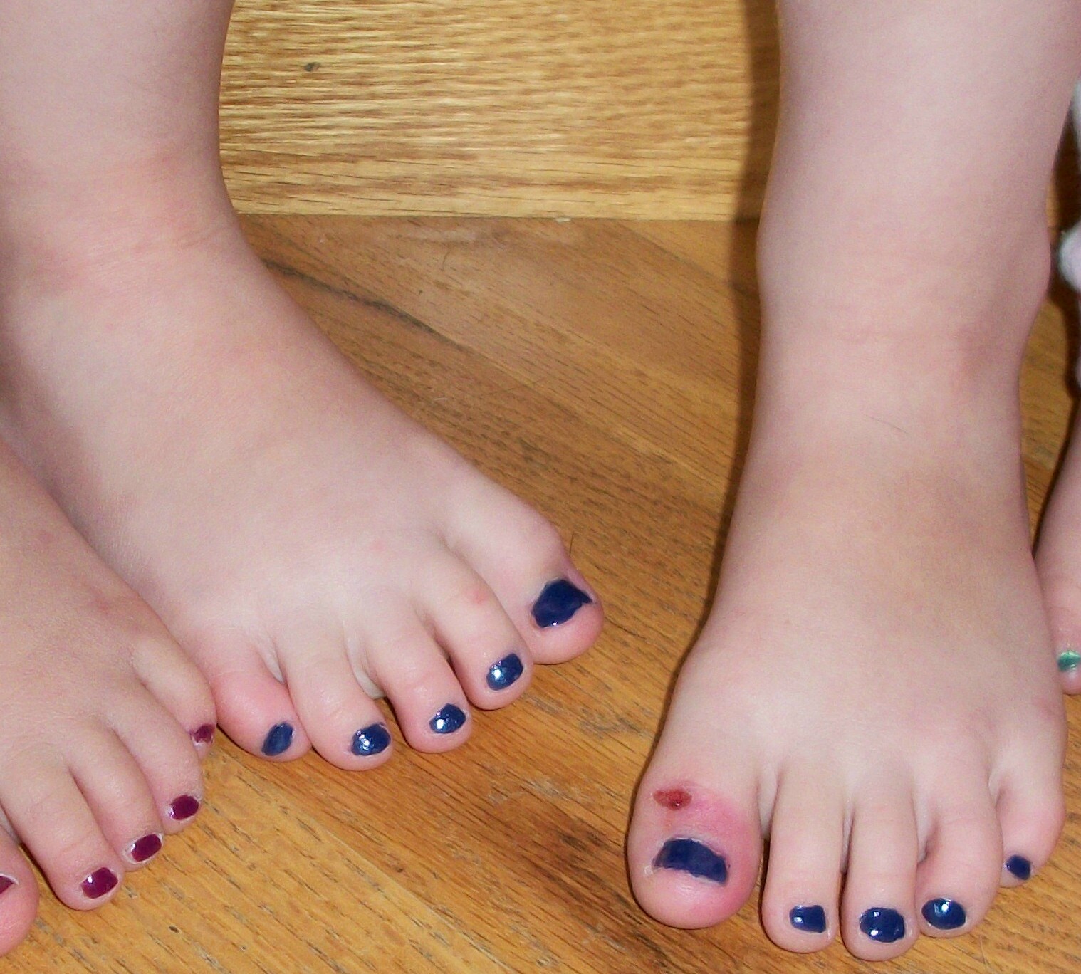 Fifty Tiny Toes Picture Of The Day Thirty Tiny Pedicured To
