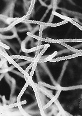 Bakteri Tanah Penghasil Antibiotik