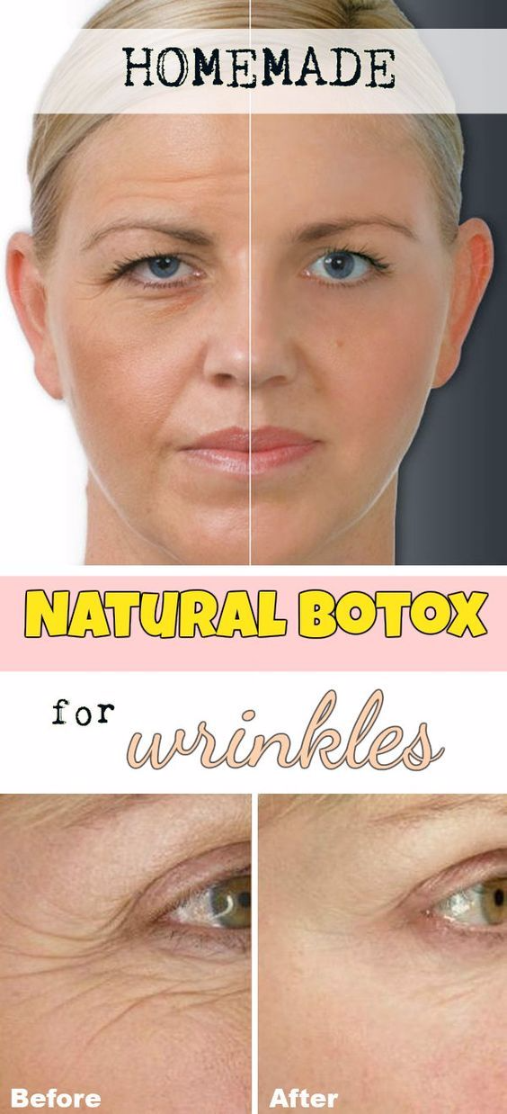 Facial Mask With Botox Effect. Cheap and Easy to Make Tips Collection