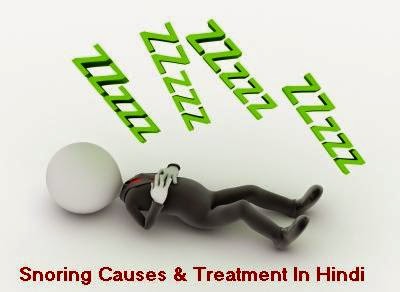 Snoring Causes and Treatment In Hindi