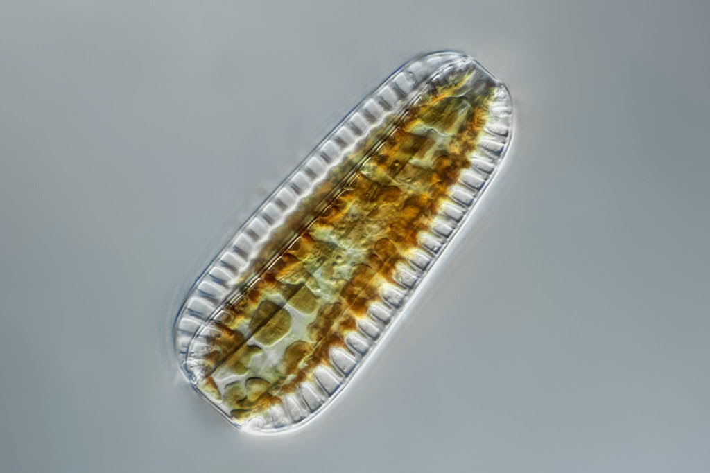 Surirella Robusta under the microscope