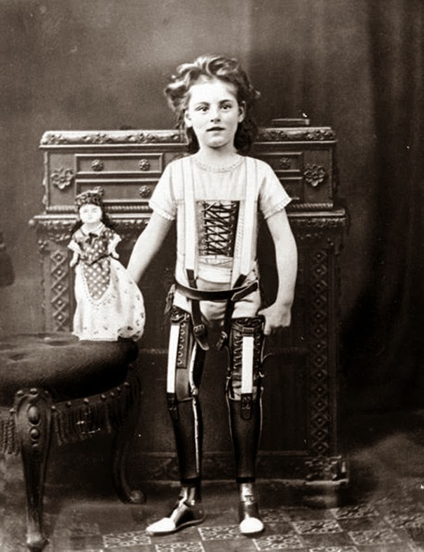 40 Must-See Photos Of The Past - Artificial legs, UK, ca. 1890