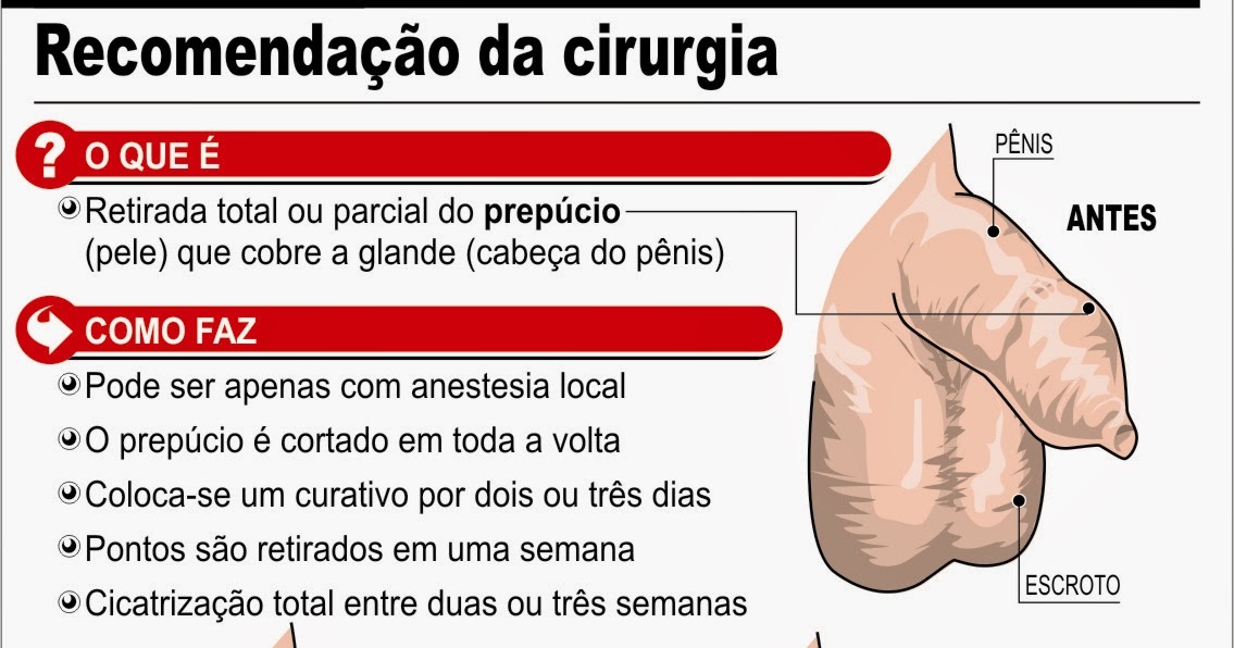 Sermões do Pr Eliel Amaral Soares: O que significa circuncisão?
