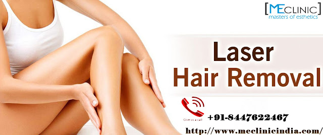 Laser Hair Removal Procedure 