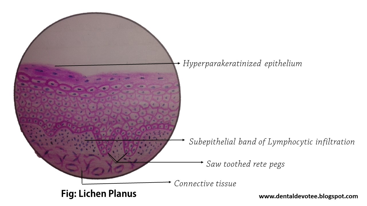 Osmf thesis 03 picture