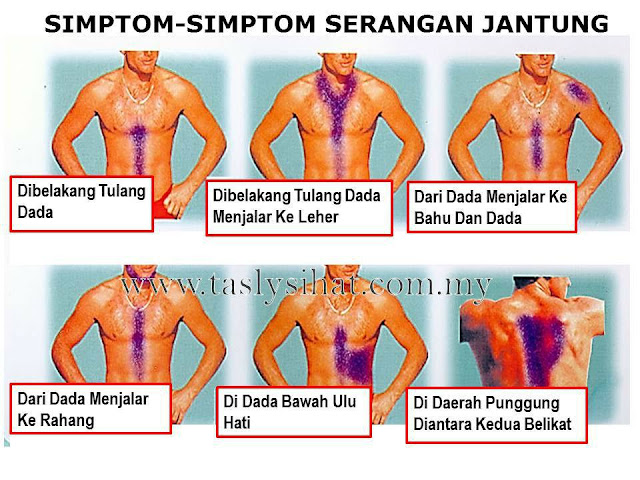 simptom sakit jantung