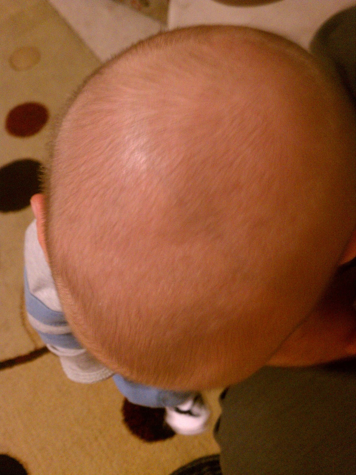 Wishes do come true... Cranial Remolding Orthosis (Helmet)