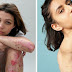 Photographer Captures People And Their Unique Scars In An Inspiring 'Behind The Scars' Photo Project