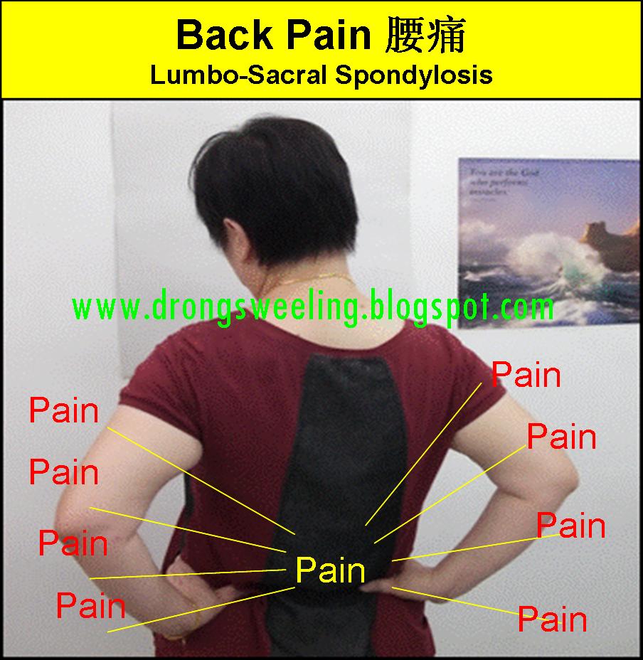 Tcm News Tcm Physician Treatment For Back Pain Lumbo Sacral Spondylosis