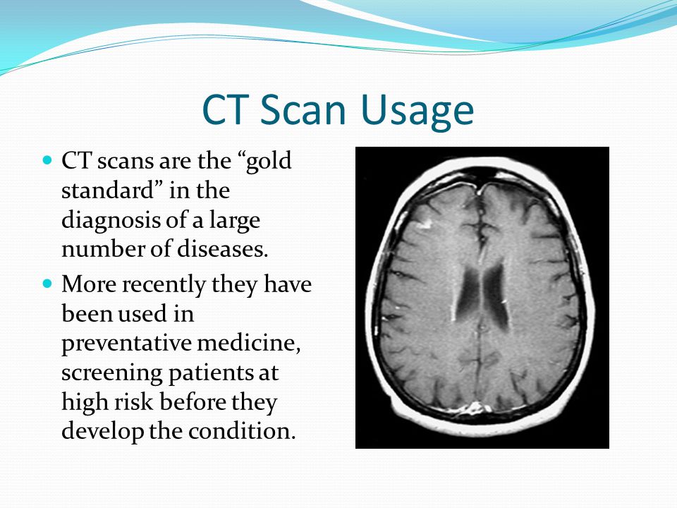 CT scan health tips by