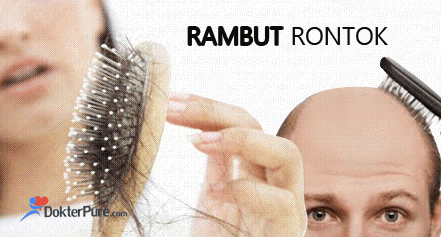 Penyebab Rambut Rontok Parah Sebabkan Kebotakan Dokterpure