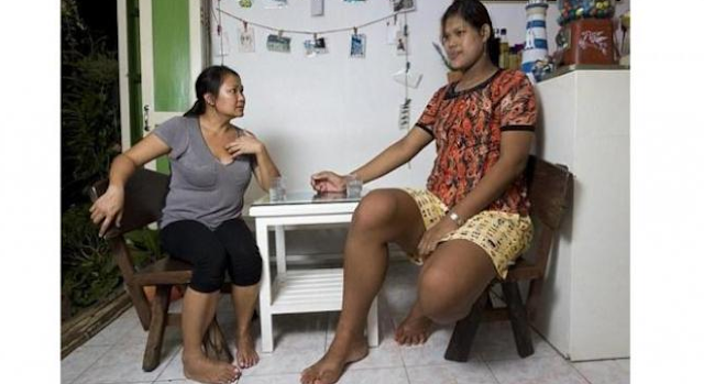 Jasad Wanita Setinggi 212 Centimeter Ini Disumbangkan Sebagai Penelitian Kedokteran
