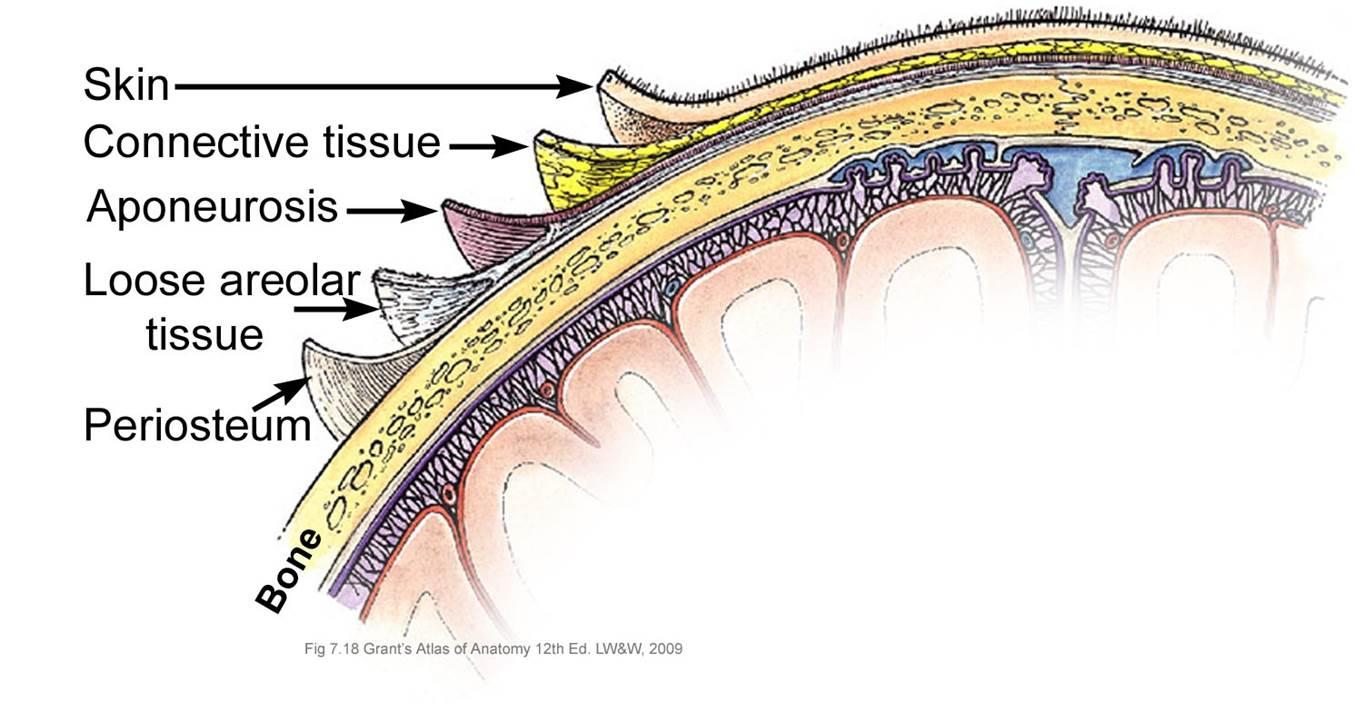 Swelling over newborn's scalp: What can it be? | Pedchrome
