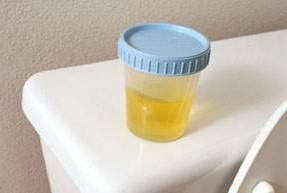 Cek Masa Subur dengan Tes Urine, Lebih akurat dibanding metode kalender.