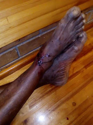 4 Xenophobia: Nigerian Auto Mechanic beaten to death in South Africa (graphic photos)