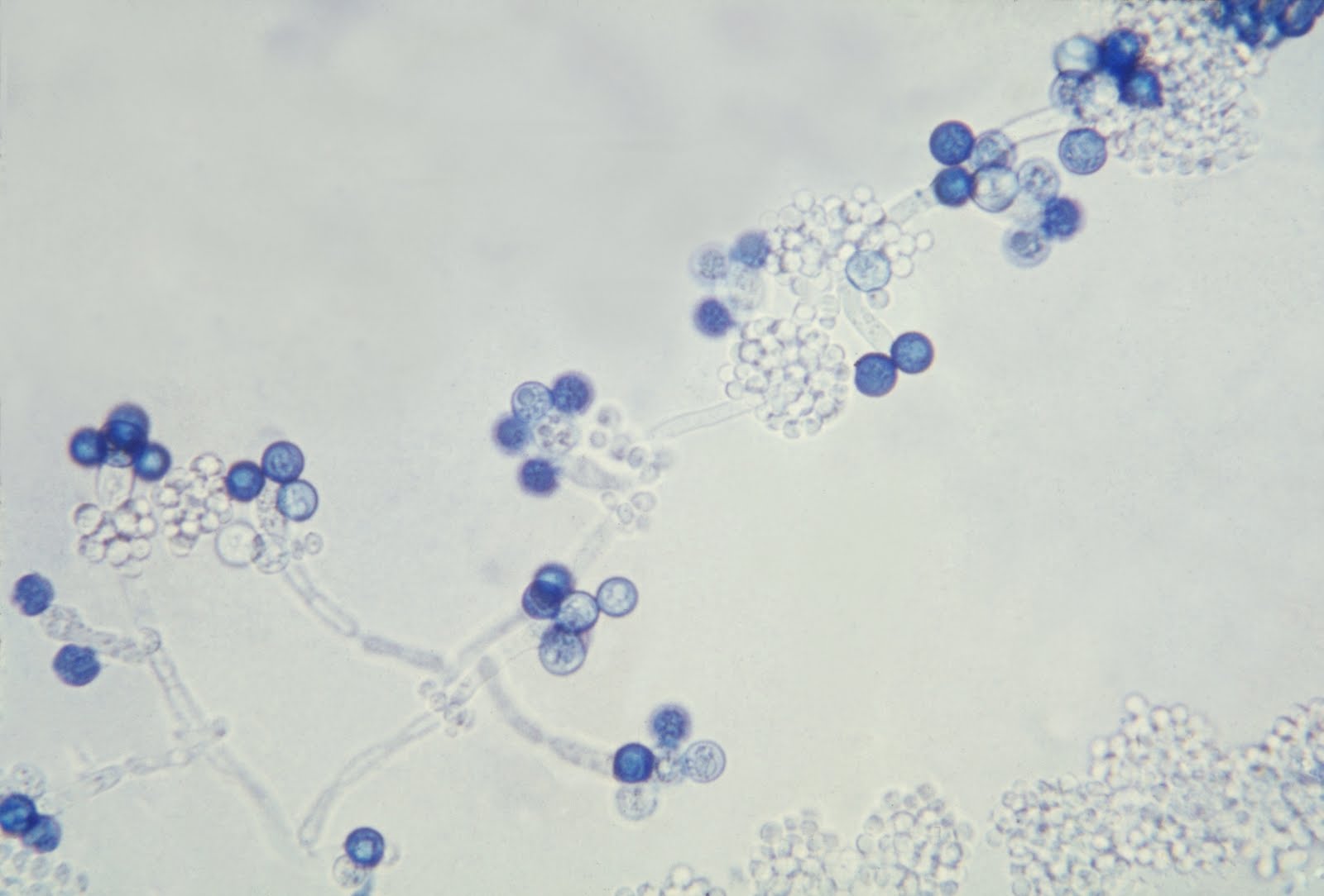 MICROBIOLOGIA MICOLOGIA MICROBIOLOGIA MICOLOGIA