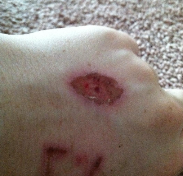 Check out the dangerous 'Eraser Challenge' kids are trying out on