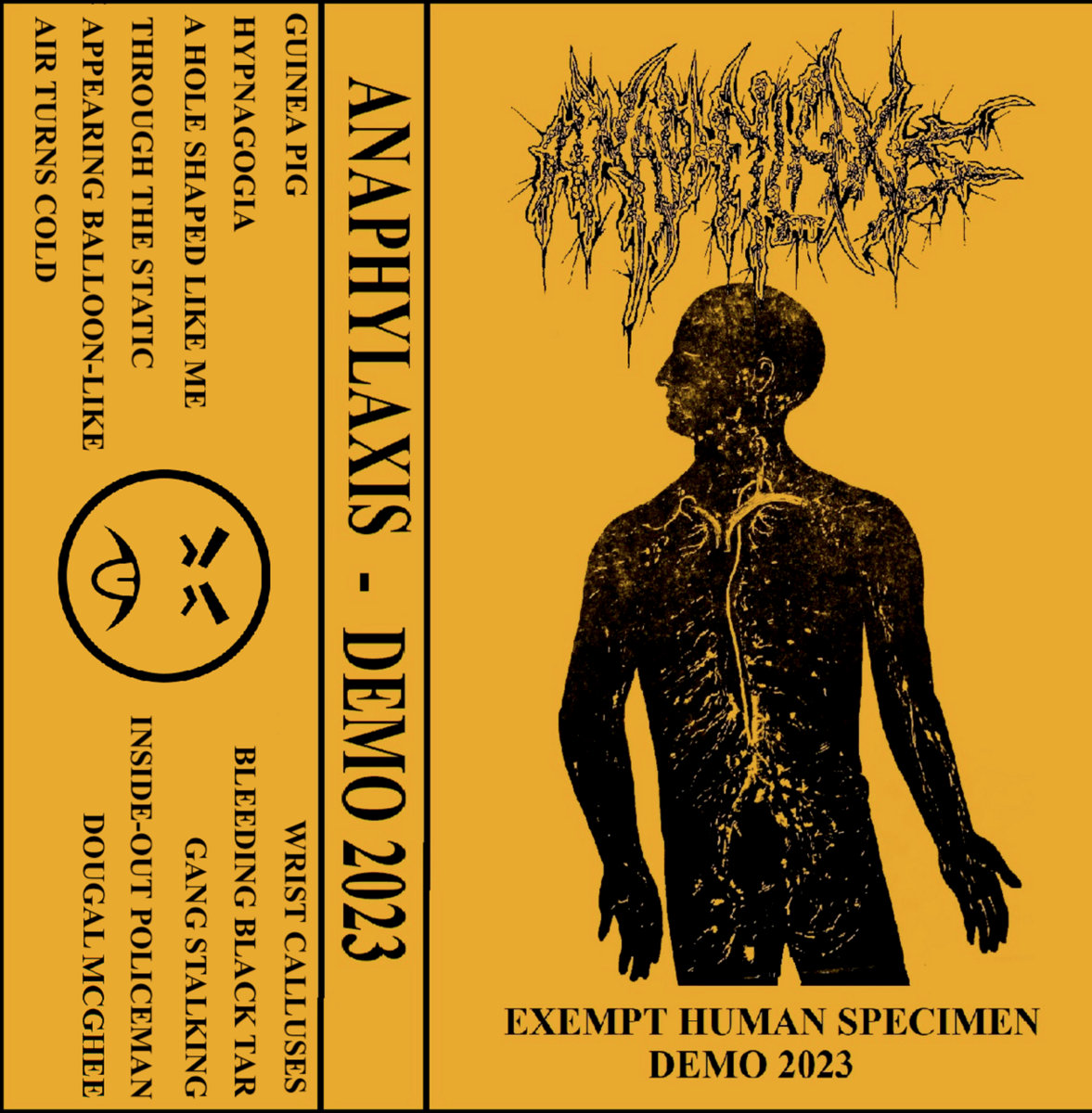 Anaphylaxis - "Exempt Human Specimen" Demo - 2023