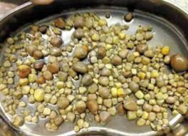 Dokter Sampai Syok Harus Mengeluarkan 420 Batu dalam Ginjalnya,Ternyata Penyebabnya Karena Ia Suka “Makan Ini” Tiap Hari