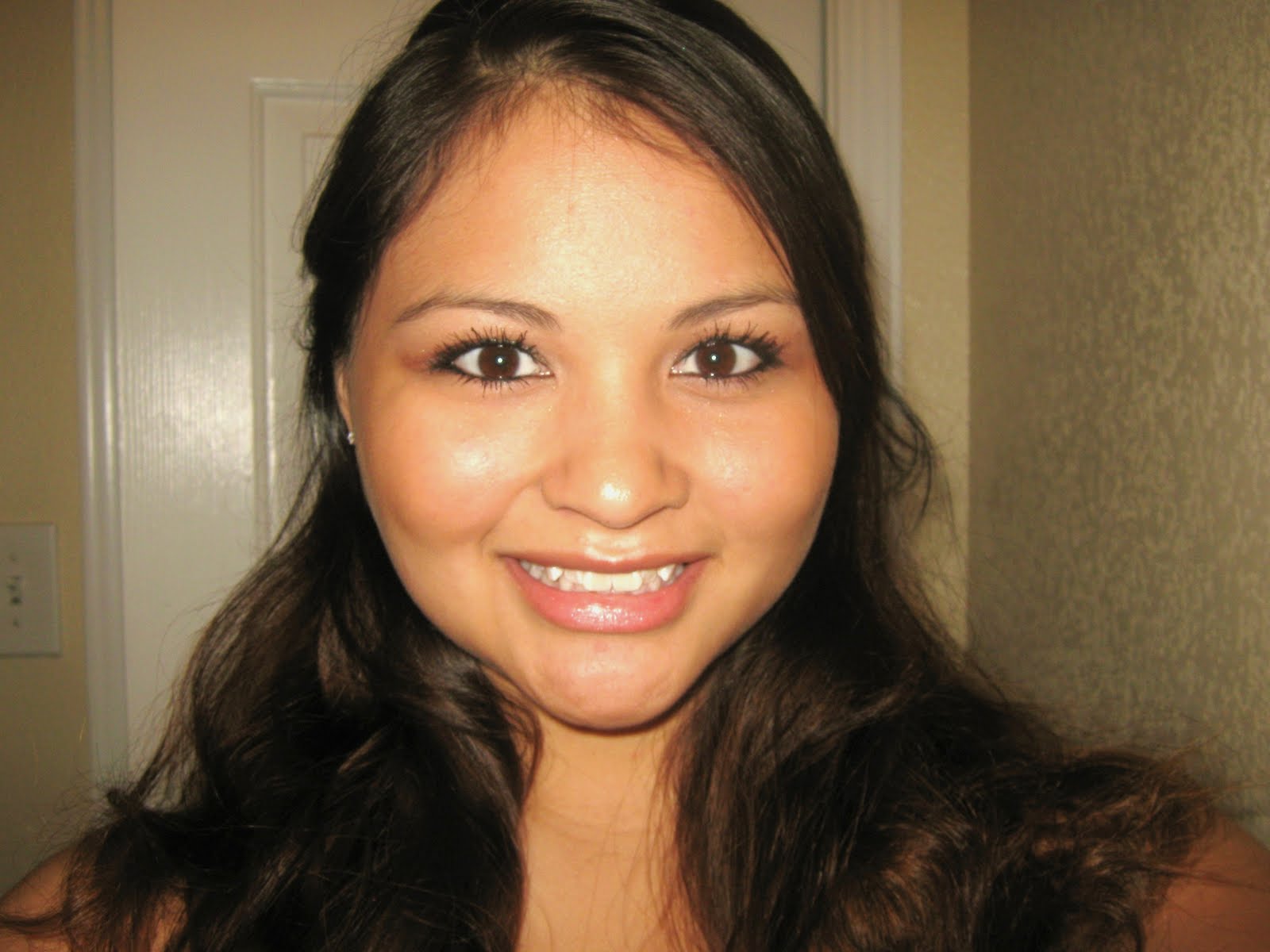 Brndy's Invisalign Journey Tray 3