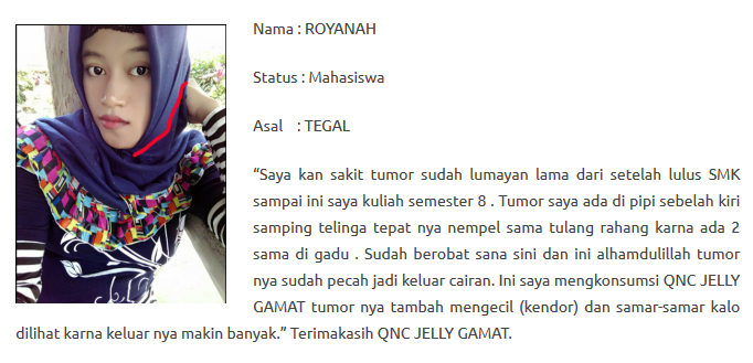 Cara Menyembuhkan Rahang Bawah Telinga Sakit Dan Bengkak Sampai Tuntas ~ Testimoni QnC Jelly Gamat Cara Menyembuhkan Rahang Bawah Telinga Sakit Dan Bengkak Sampai Tuntas ~ Testimoni QnC Jelly Gamat