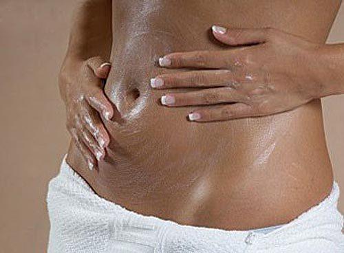 How to Naturally Get Rid of Your Stretch Marks