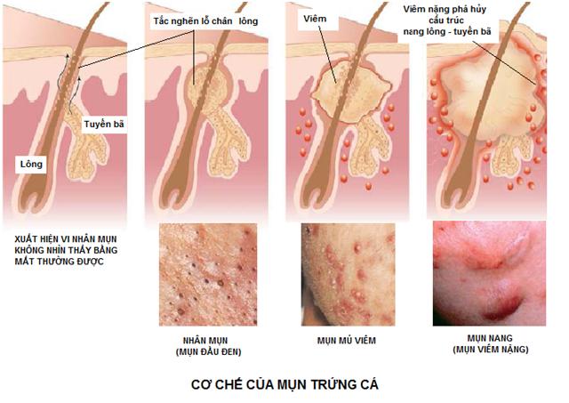 Co che cua mun trung ca