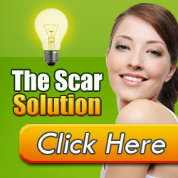 Stop Acne Scars