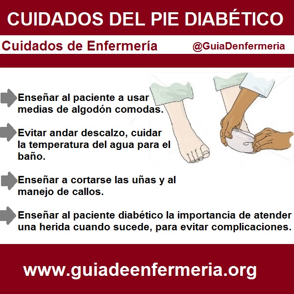 CUIDADOS DE ENFERMERÍA PIE DIABÉTICO GUÍA DE ENFERMERÍA