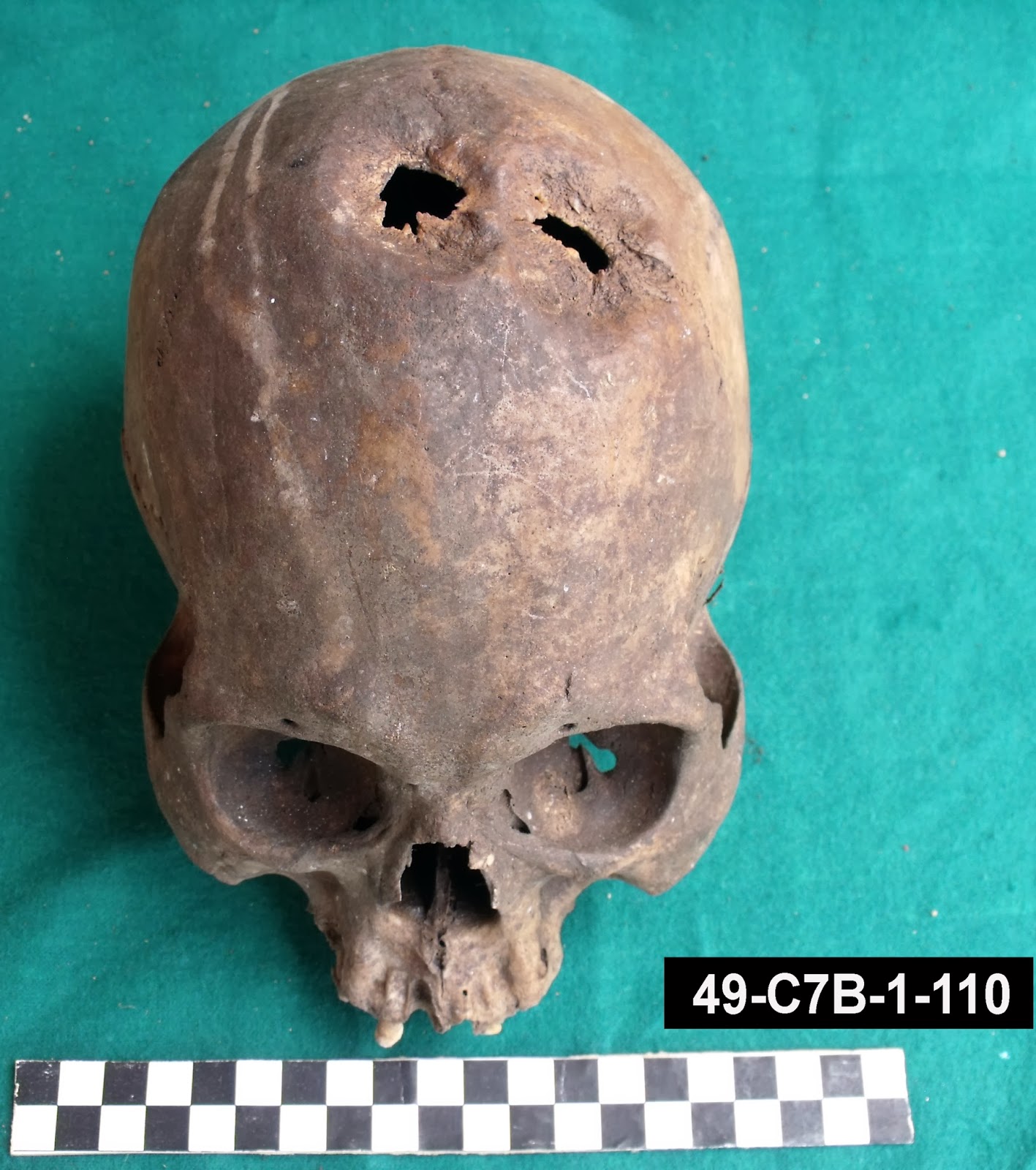 Bioarchaeology of Ancash Skull Trepanations